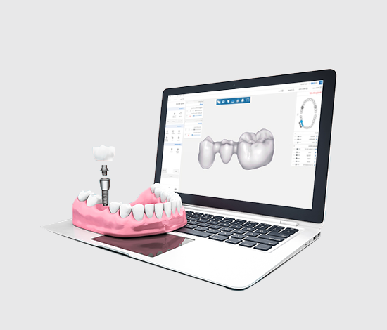 치과보철물 3D 디자인프로그램