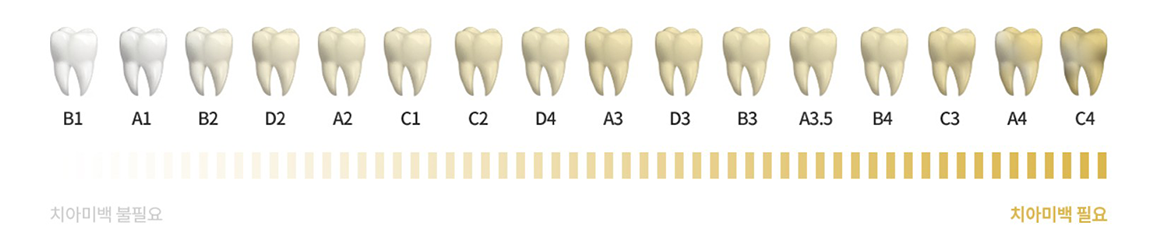 치아색상가이드