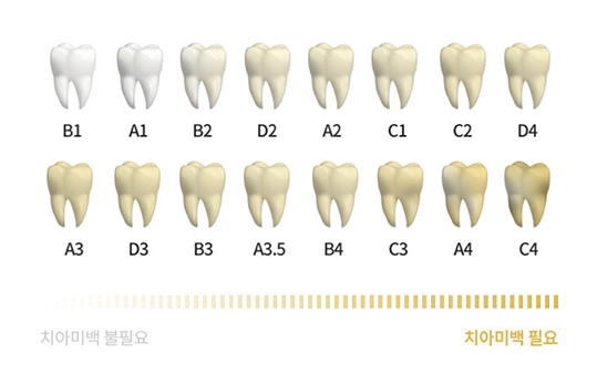 치아색상가이드